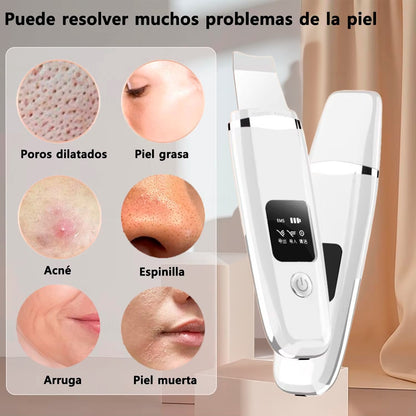 LIMPADOR FACIAL ULTRASÓNICO