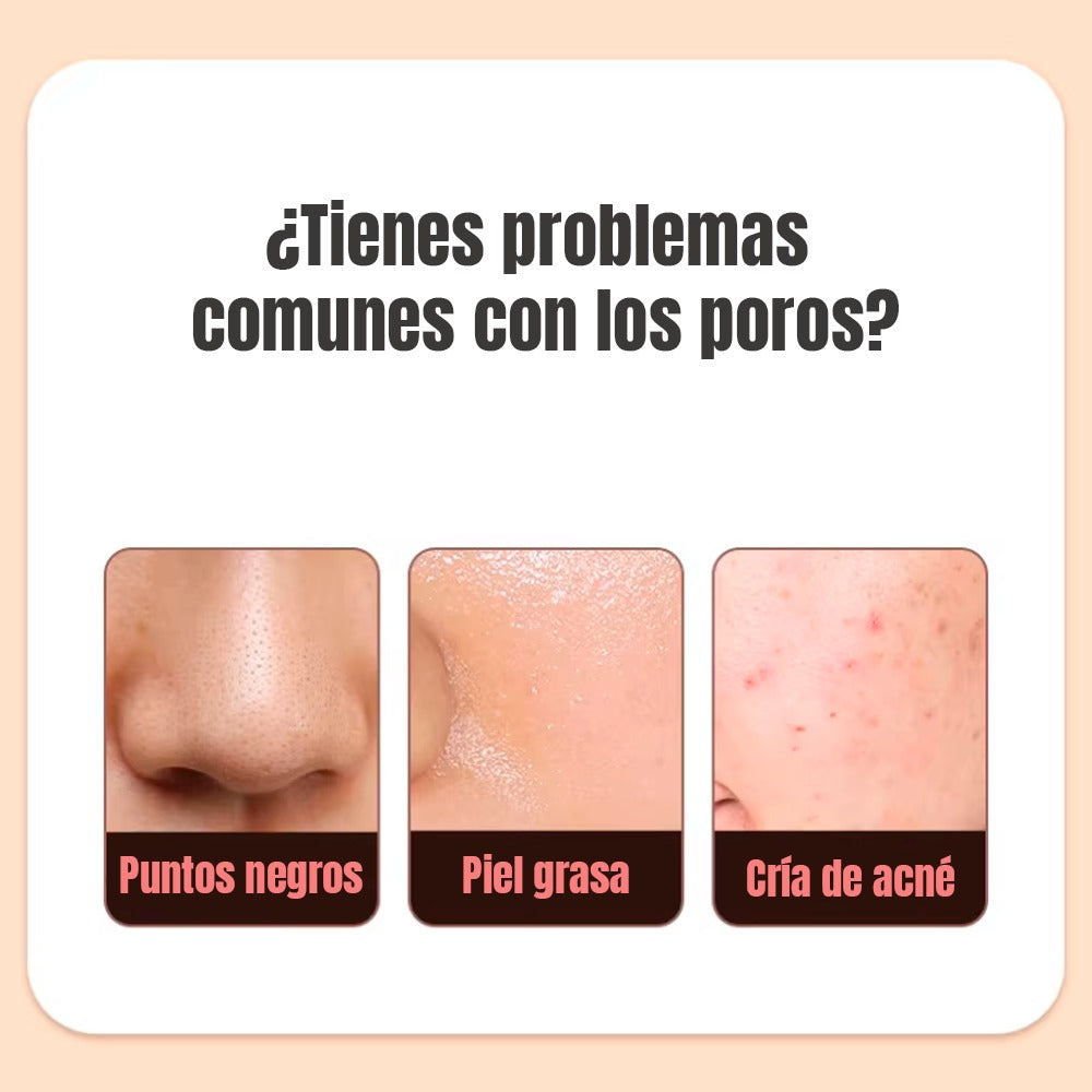 LIMPADOR FACIAL ULTRASÓNICO